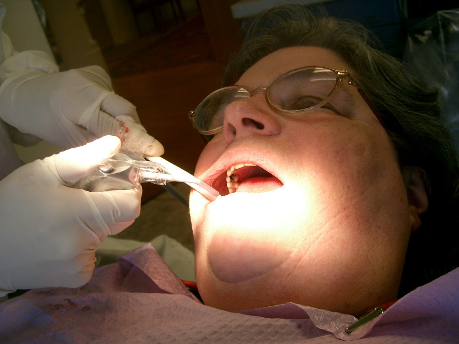 A dental hygienist treating a patient